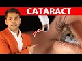 Eat This Every Day To Prevent Your Eyes From Cataract  - Dr. Vivek Joshi