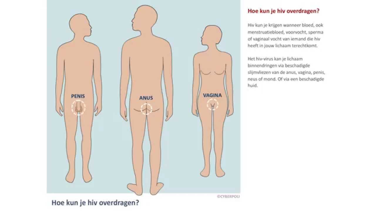 Hiv HIV and