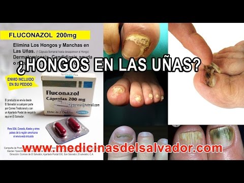 El hongo de las uñas y el estrés El tratamiento del hongo de la uña por el láser en tolyatti