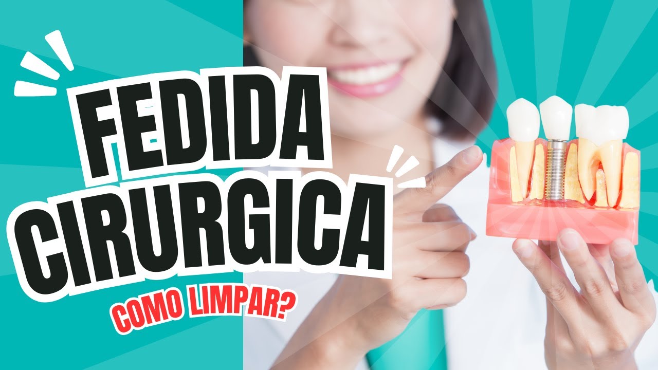 COMO LIMPAR UMA FERIDA CIRÚRGICA APÓS INSTALAÇÃO DOS IMPLANTES.