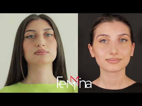 FEMINA 3 - Ինձ ծաղրում էր ընկերուհիս...Նարինեն վիրահատությունից հետո՝ 8-րդ հաղորդում