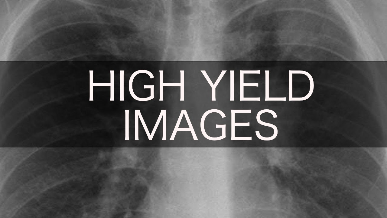 High Yield USMLE/COMLEX Images (pt. 3)
