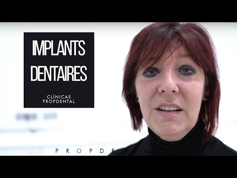 download lagu mp3 mp4 Implant Dentaire Barcelone Prix, download lagu Implant Dentaire Barcelone Prix gratis, unduh video klip Implant Dentaire Barcelone Prix