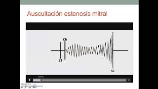 Cardiopatía Valvular - Clase II - Dr. Gabriel Parma.