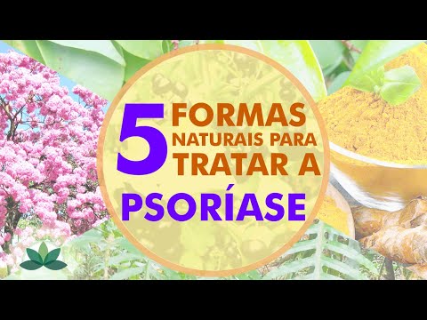 5 natural ways to treat psoriasis!