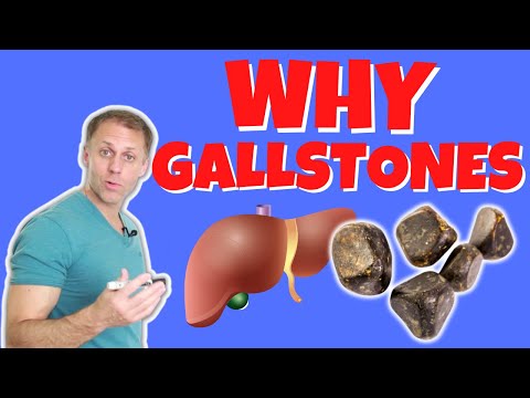What Causes Gallstones and How to Treat Them