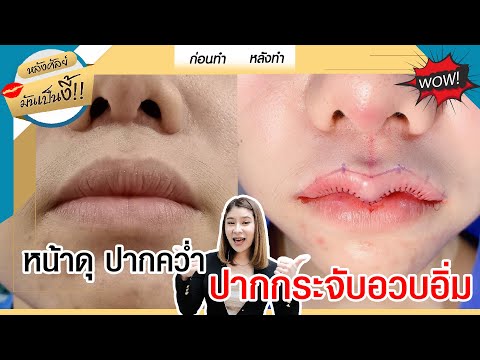 ทําปากกระจับ