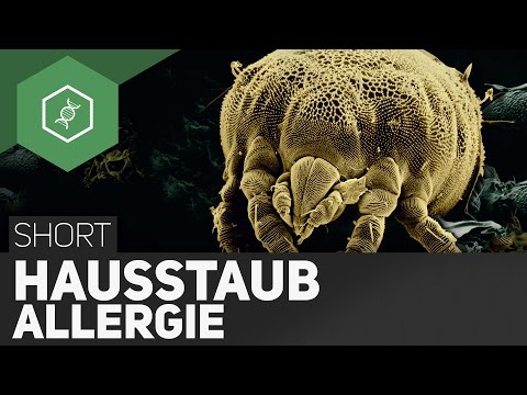 Als das Ekzem auf den Händen des Kindes zu behandeln Ob man von der Tinktur der Ringelrose die Schuppenflechte behandeln kann