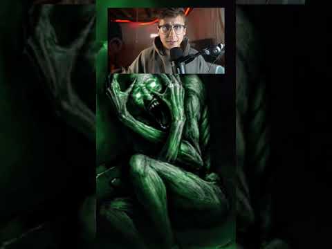 3 Ways To Survive SCP 096 😳 #shorts