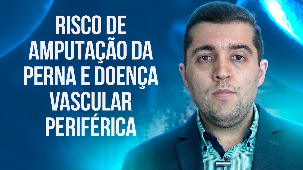 Má circulação que pode causar amputação da perna: conheça a doença arterial obstrutiva periférica