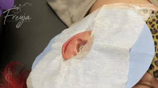 Helix Piercing
