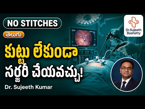 Benefits of Laparoscopic Surgery