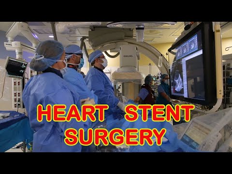 Heart Stent Surgery