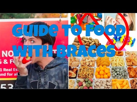 Guide To Food With Braces!!! || What can you and can't you eat?