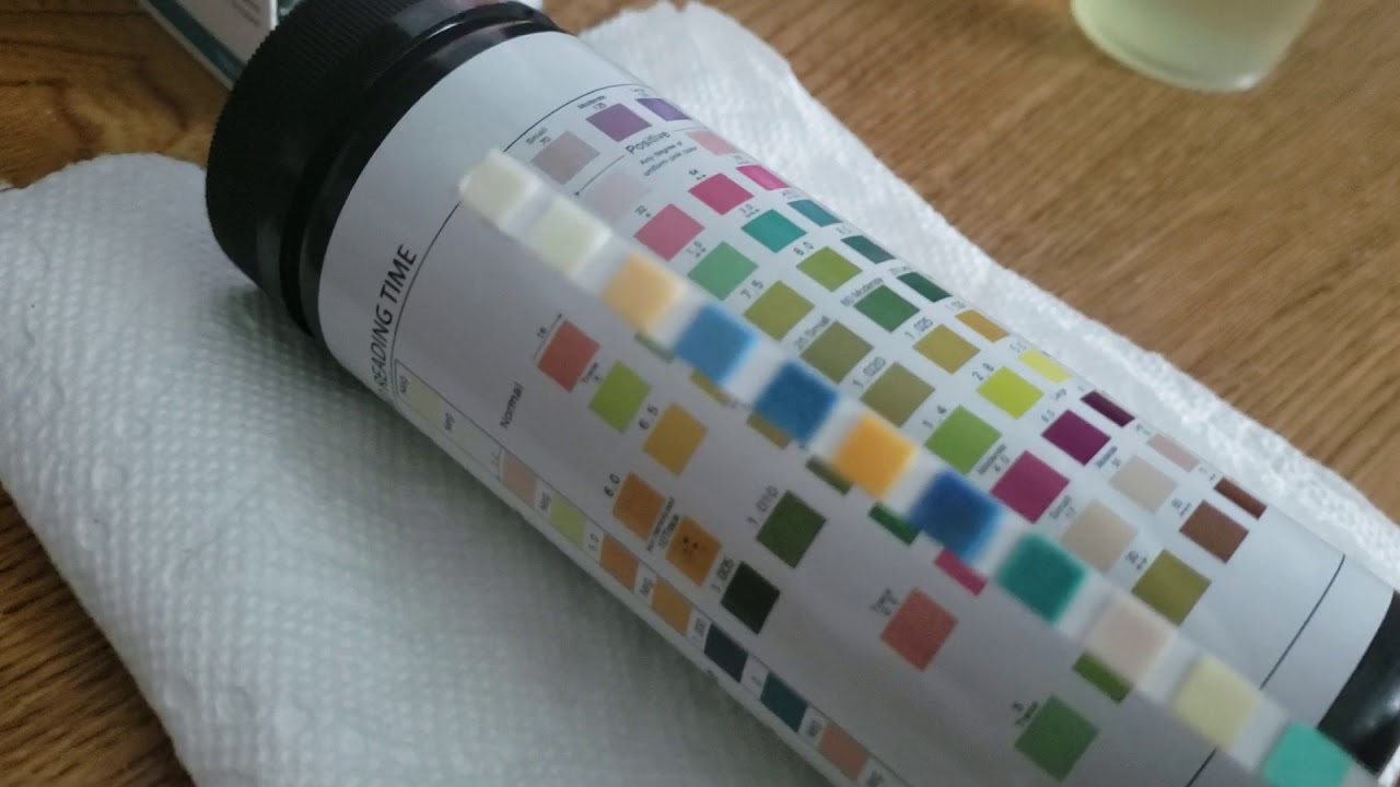 How To Read Urine Test Strips