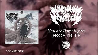 Frostbite Music Video