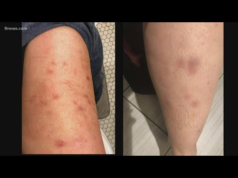 'It feels like a parasite in my body': How a routine knee replacement could cause big complications