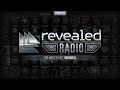 Revealed Radio 016 - Hosted by Hardwell ...