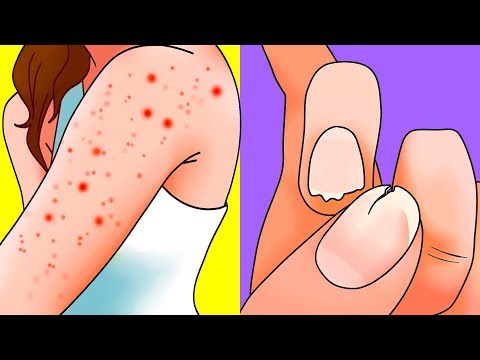 あなたの体がもっと睡眠を求めている7つの警告サイン