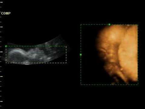 29 weeks old baby in the womb