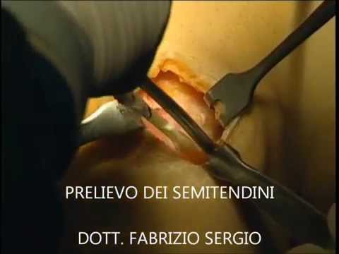 Risonanza magnetica del ginocchio in Novogireevo Intervento chirurgico sul congiunta nei cani