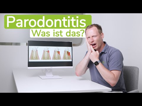 Parodontitis: Was ist das eigentlich? | m71 - Zahnärzte am Markt - Dr. Frank-Ch. Langer