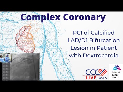 PCI of Calcified LAD/D1 Bifurcation Lesion in Patient w/ Dextrocardia - December 2012 Webcast Video