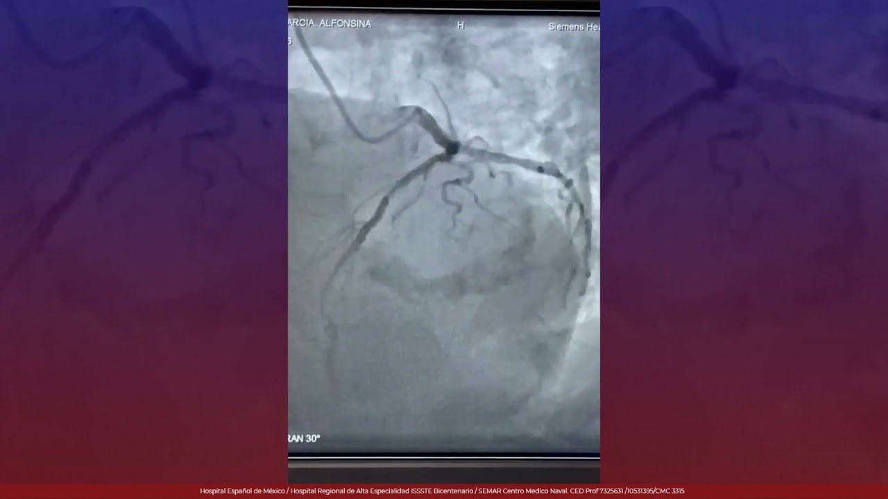 Marcelo Utrera Lagunas-111