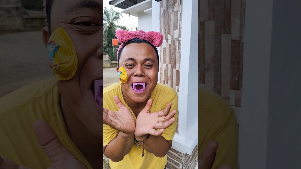 Gigi palsu #เด็กน่ารัก #น้องมิลิน #ตลก #โบ๊ะบ๊ะshorts