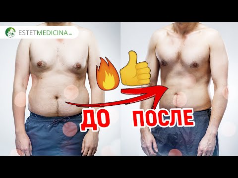 Sayawan sa isang poste para sa pagbaba ng timbang Paano alisin tiyan taba nang walang surgery