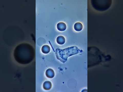 Бактерия в крови: мгновенный ответ иммунной системы