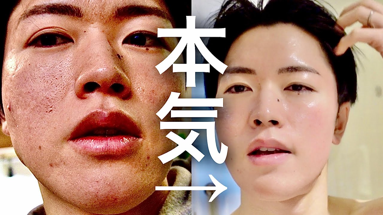 【毛穴・シミ・ニキビ跡】本気の人用スキンケア『2選』