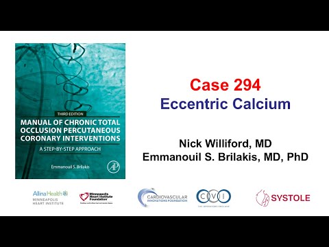Case 294: Manual of CTO PCI - Eccentric calcium