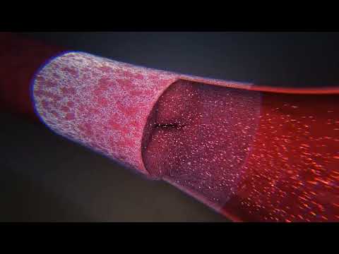 ICMS video to introduce van Hest