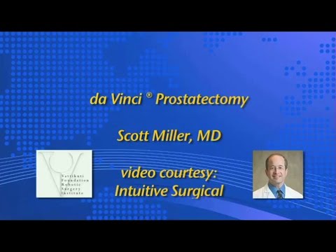 da Vinci Prostatectomy