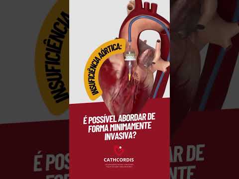 Hedilberto Feitosa-24