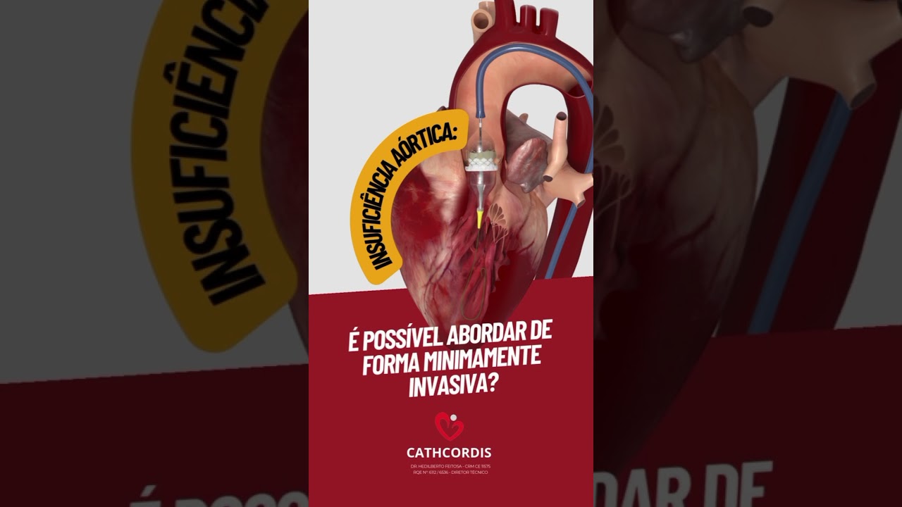 Hedilberto Feitosa-24