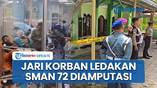 Kondisi Terkini Korban Ledakan SMAN 72 Jakarta, Alami Pecah Gendang Telinga hingga Jari Diamputasi