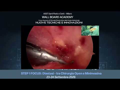 Focus 1 - Live Surgery con Federico Fiori: TESAR