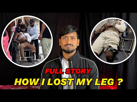 How i lost my leg ? 🥺❤️‍🩹 | theironleg |  
