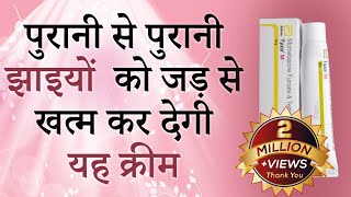 पुरानी से पुरानी झाइयों को जड़ से खत्म कर देगी यह क्रीम-  Tyza M | Mometasone Furoate