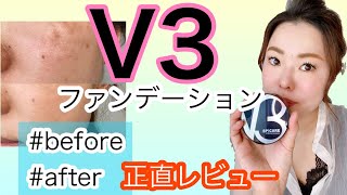 【V3ファンデーション】気になるbefore・after