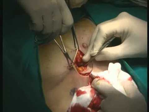 Osteocondrosi cervicale collare I raggi X del ginocchio sano Photo