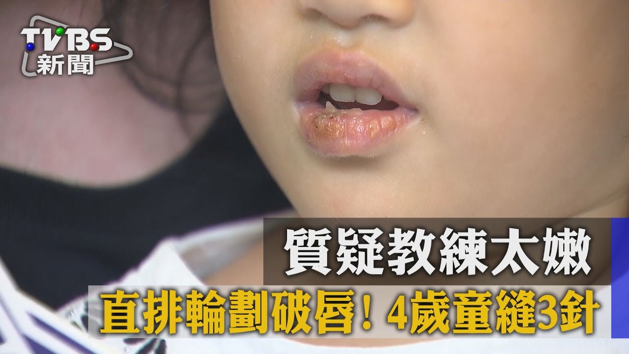 獨家/直排輪劃破唇!4歲童縫3針 質疑教練太嫩