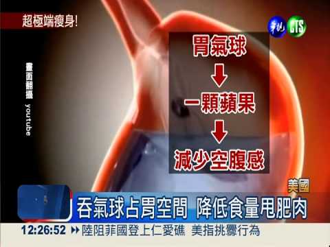 吞氣球減肥?! 號稱3個月瘦9公斤