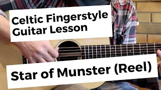 Star of Munster: Celtic Fingerstyle Guitar Lesson