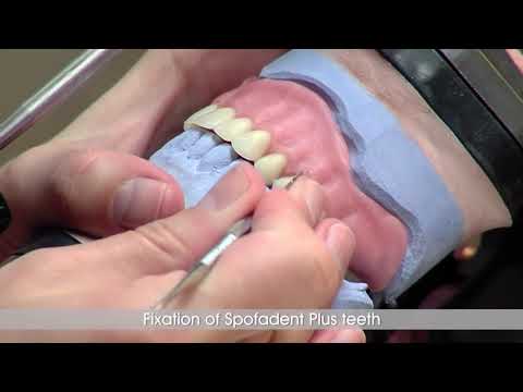 Оттискной материал эластик хромо Elastic Cromo 450гр. кромо альгинат оттиск масса для слепков - фото 1 - id-p11529872