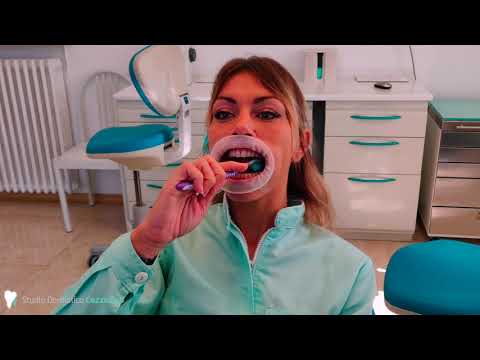 Come si usa bene lo spazzolino da denti?