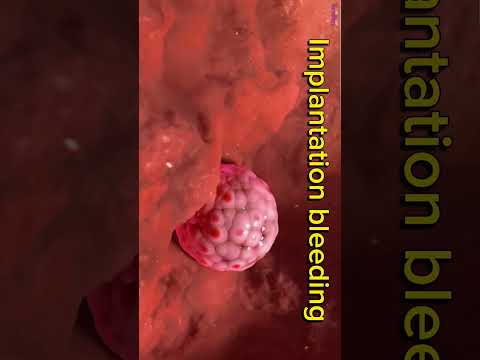 Implantation Bleeding || Pregnancy Loss #shorts #pregnancy