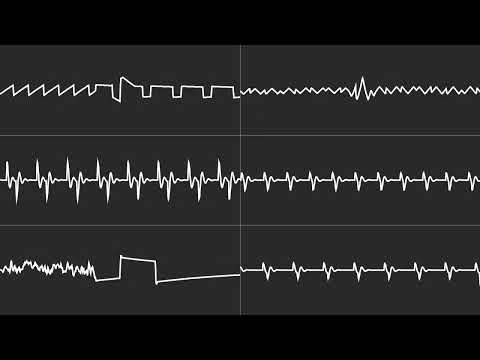 COMMODORE C64 SID 2023 - R TYPE AMIGA 2 SID - JASON PAGE - 6 CHANNEL MONO TUNE / Oscilloscope View